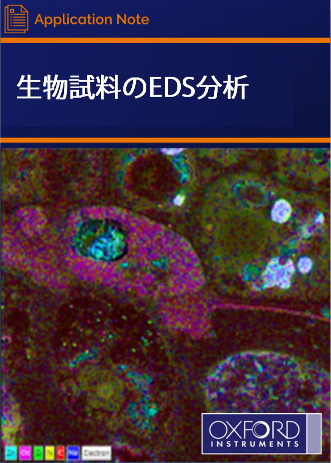 EDS Analysis for Biological Samples