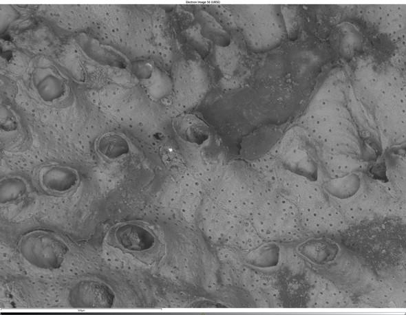 貝殻上堆積物　15kV　低真空