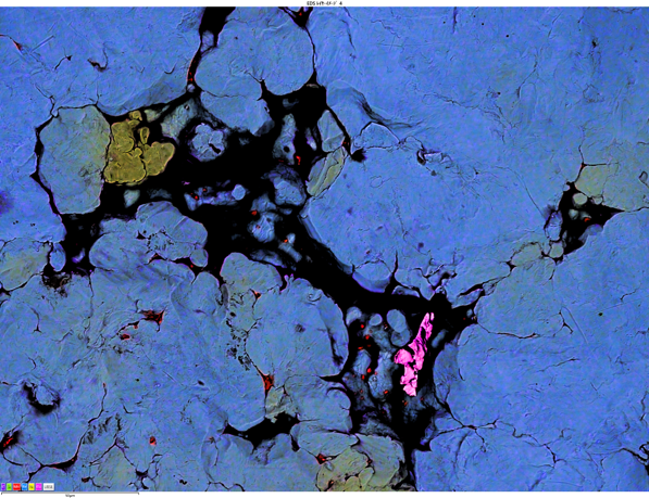Unity によるBEXイメージング：焼結金属ギヤ表面（粉末冶金）　15kV