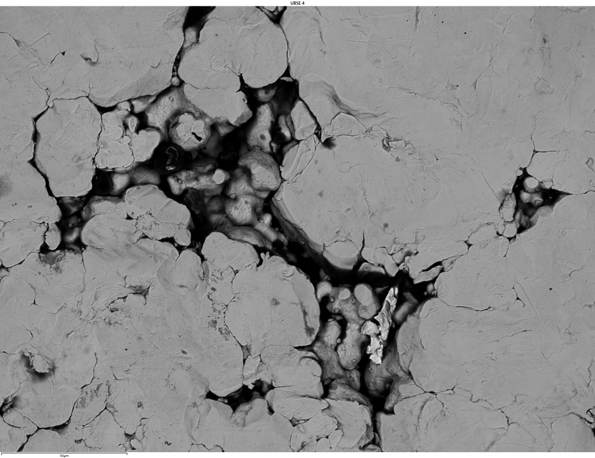 SEMによる 反射電子イメージング：焼結金属ギヤ表面（粉末冶金）　15kV