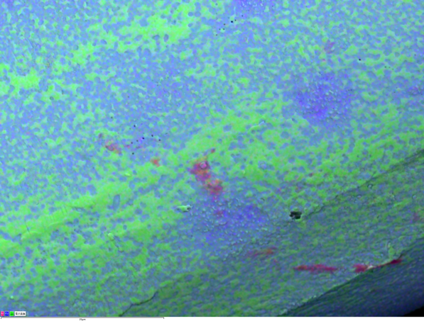 Unity によるBEXイメージング：編込金属線