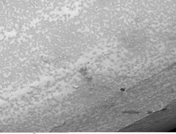 SEMによる 反射電子イメージング：編込金属線