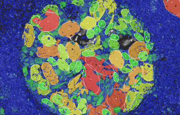 Grain size map of a chondrule in a carbonaceous chondritic meteorite